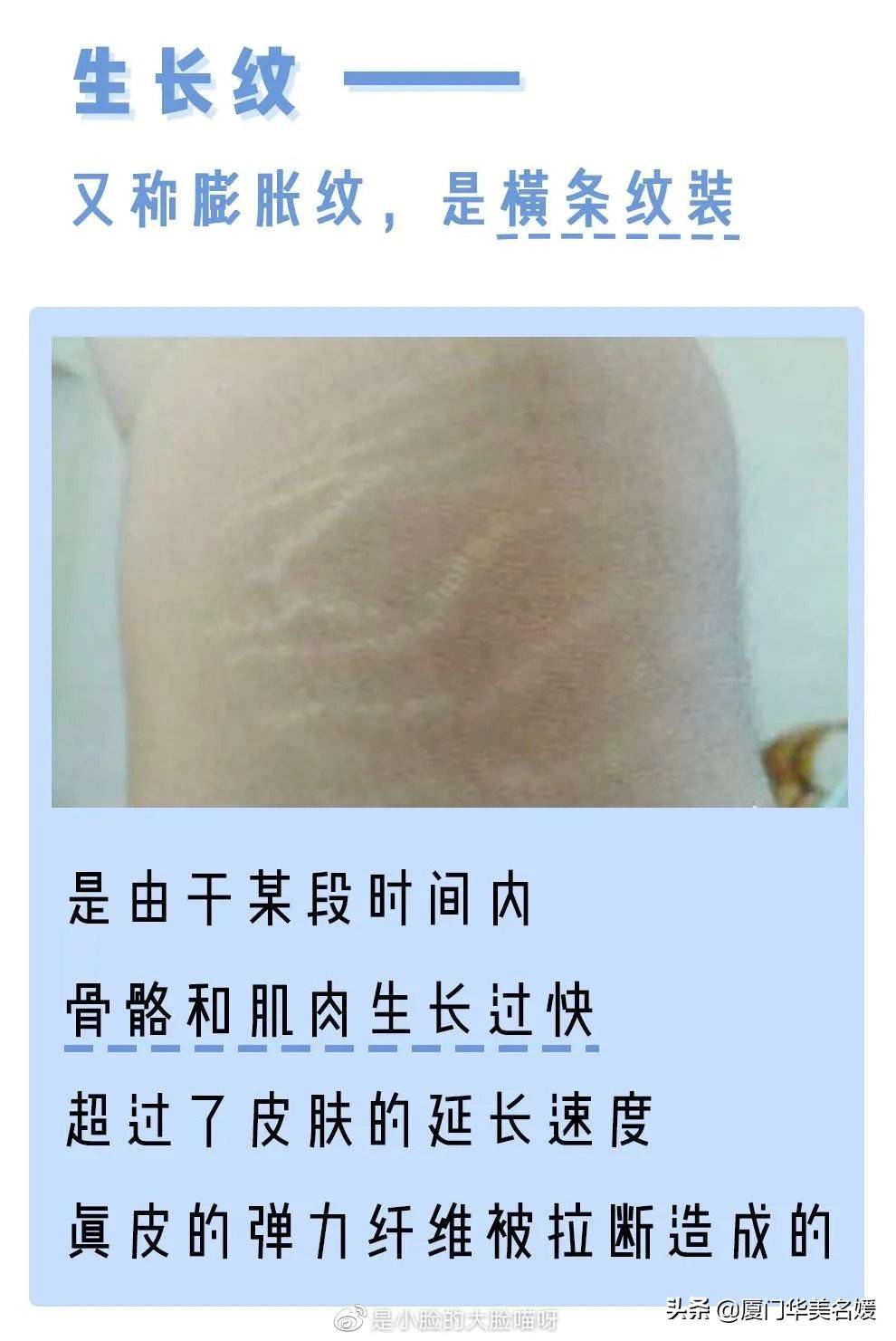 799244eb2c5d4bd590b5787fe8ad73e5.jpeg