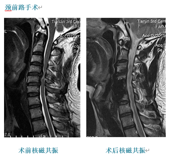 一半脑袋麻木怎么办