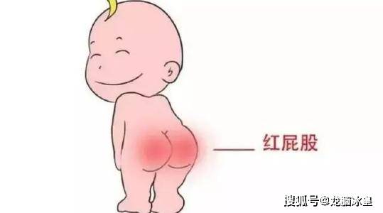 龙脑冰皇小知识:宝宝红屁屁是什么原因呢?