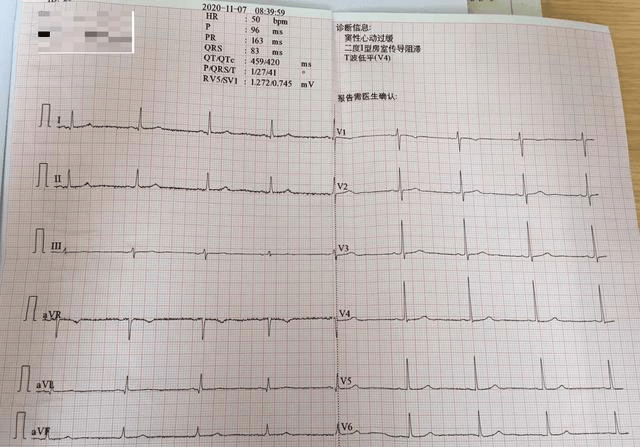 心电图t波低平就是冠心病?