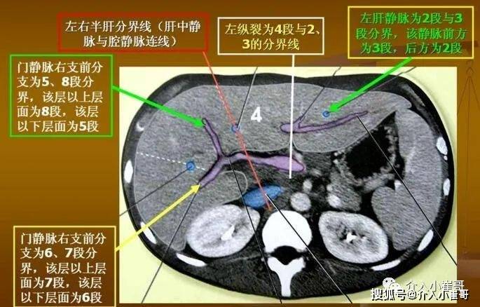 肝脏s8在哪里小崔哥为您讲解肝脏解剖位置