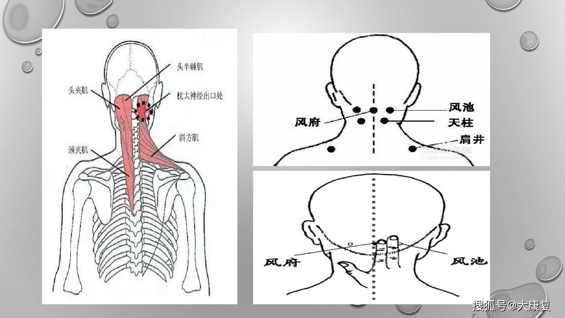 宣蛰人压痛点强刺激推拿法