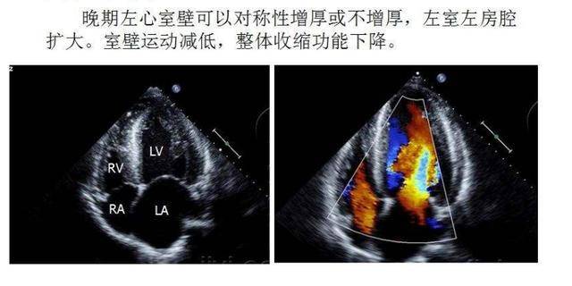 体检高血压怎么办