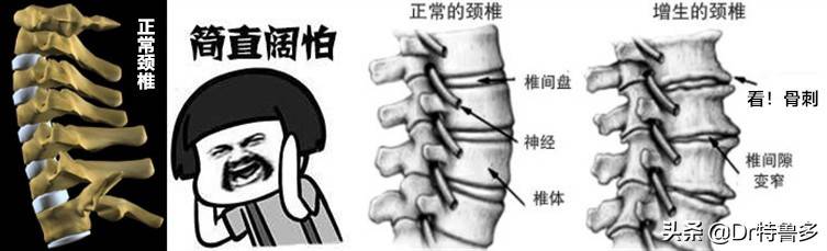 头痛头晕恶心心慌耳鸣气短气紧有可能都是因为颈椎病