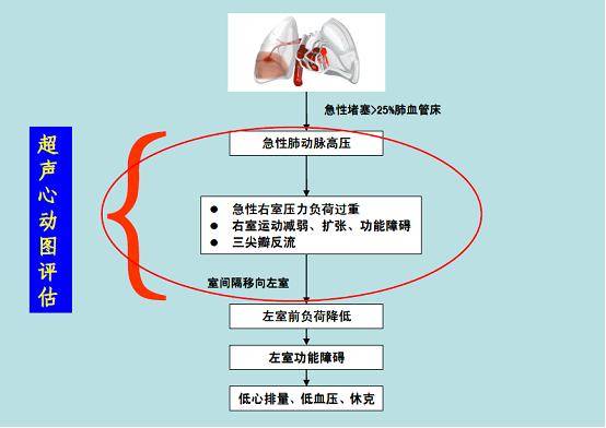 52岁大妈病情恶化,这种疾病必须警惕_栓塞