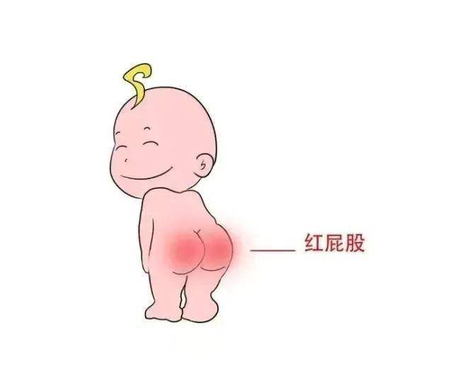 女宝宝的阴道由于与肛门距离很近,很容易会接触到粪便的细菌,为女宝宝