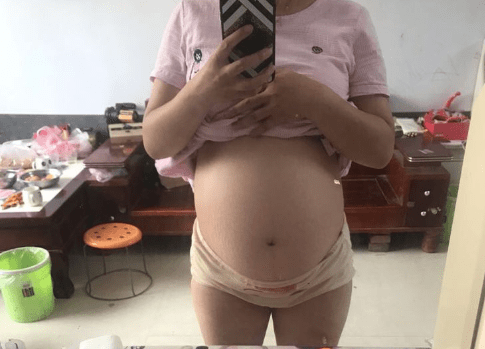 原四维彩超胎儿不配合,可有效避免此准备