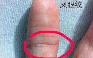 原创大拇指的凤眼能带来好运还是会破财看看你的手相有吗