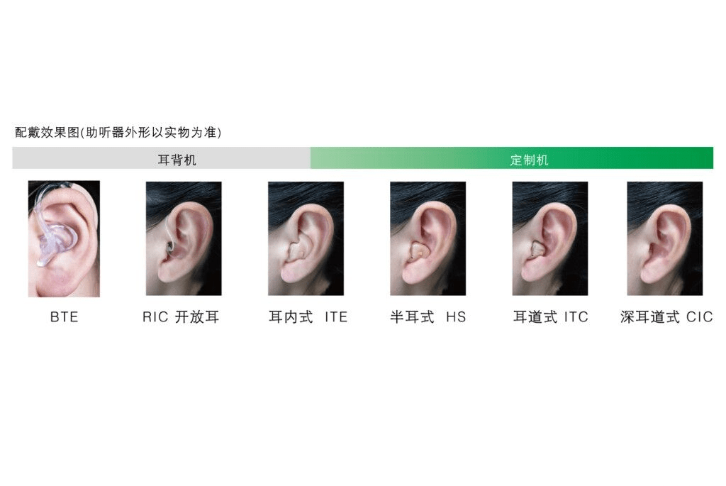 如果不对老年听力障碍者进行听觉干预,长期下去会加速听觉功能退化