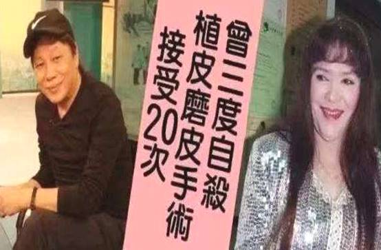 四,惨遭毁容后他的原配夫人疯狂整容,最后失望透顶的他选择了跟她离婚