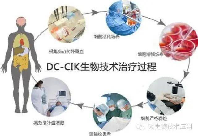 细胞生物治疗_免疫