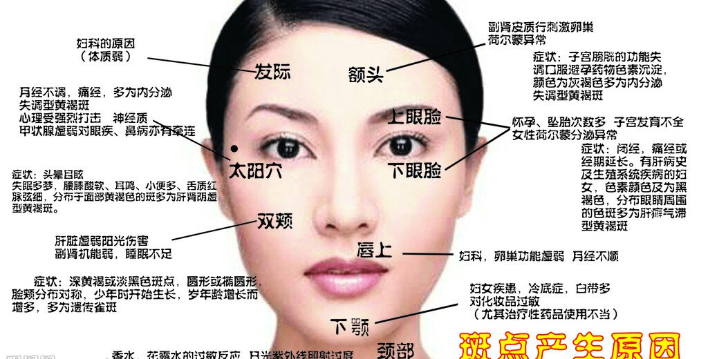 女人脸上这些部位长斑千万要注意了别以为只是皮肤问题