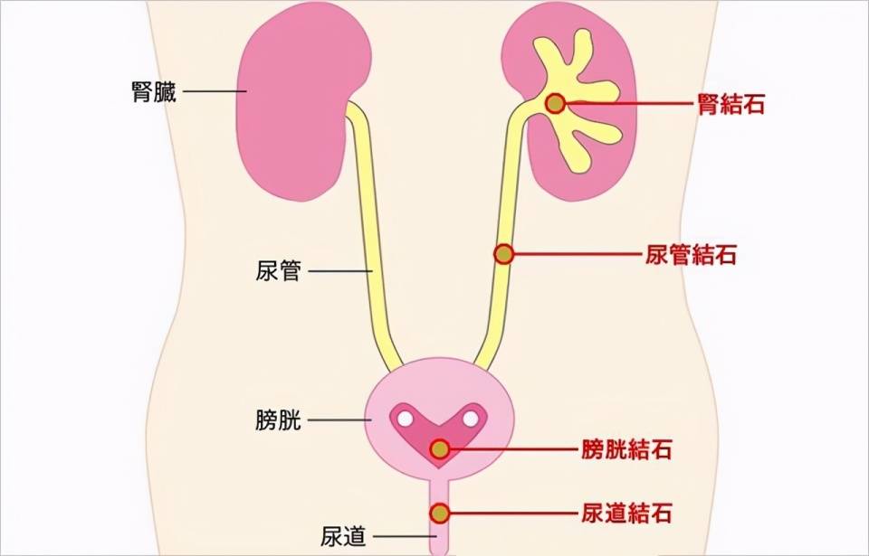 尿分叉一定是有病吗?不一定,但出现这几种情况要当心