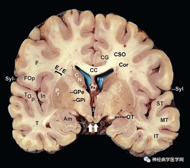 神经解剖:病损表现及定位诊断【局部精讲】
