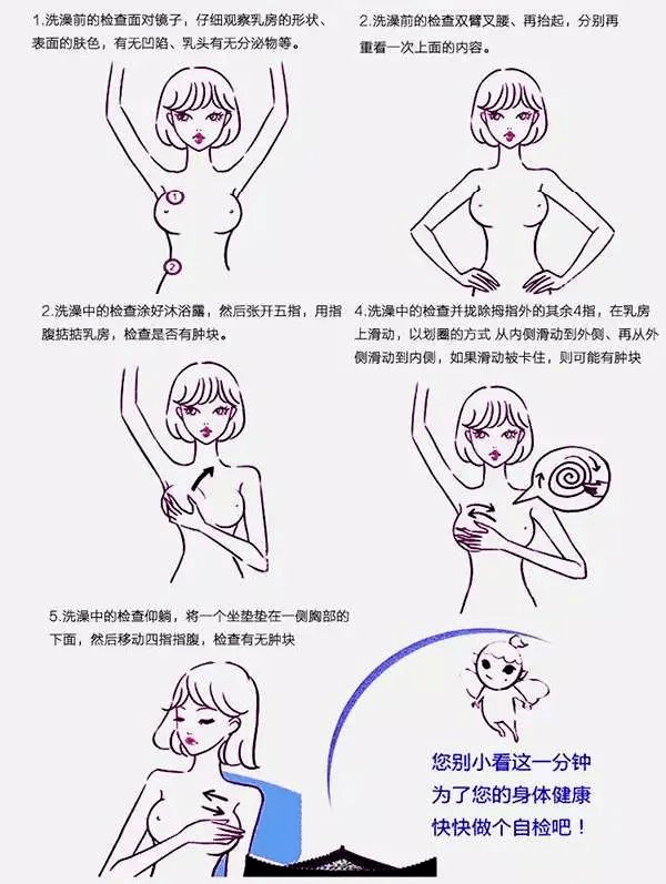 注意:如果发现任何不正常变化或乳腺疾病特有的体征,请及时就医进一步