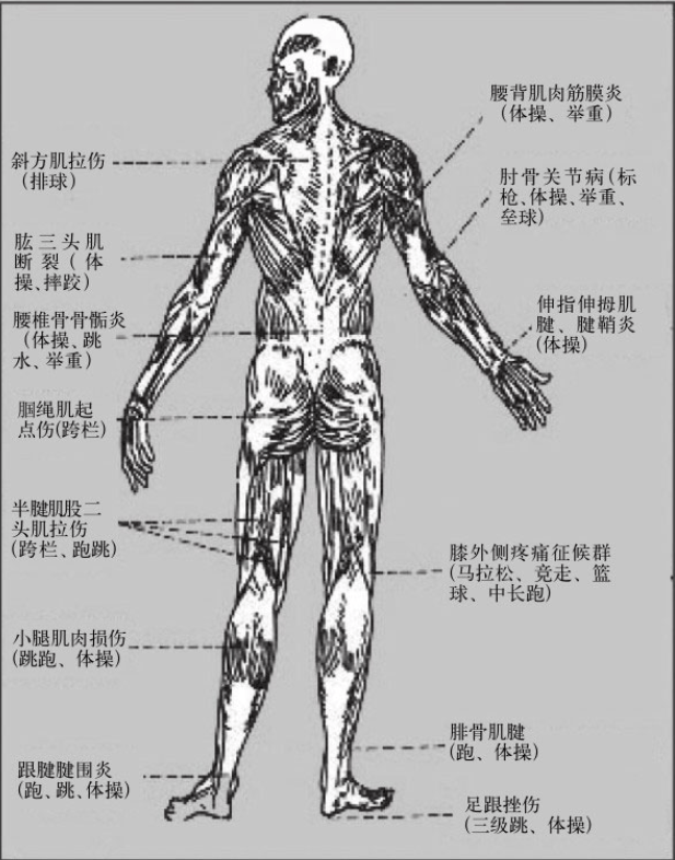 认识肌肉痉挛