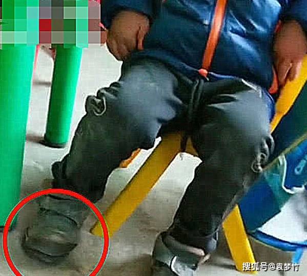 幼儿园小孩上课时,脚一直不停发抖,老师近前一瞧,瞬间