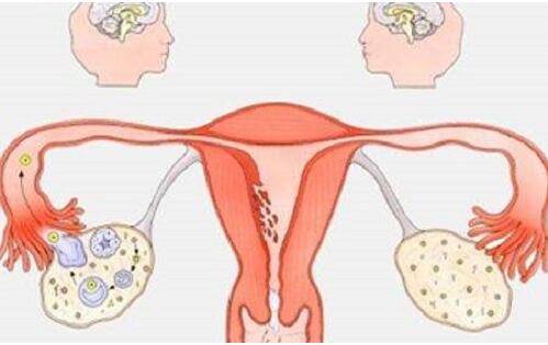 介绍一下卵巢发育异常