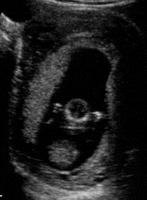 胎宝宝在腹中会＂说话＂,4种胎动形式1个求救信号,孕妈要懂