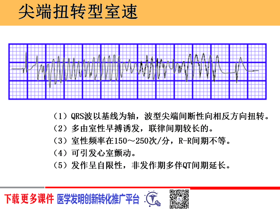 恶性心律失常心电图的识别与处理