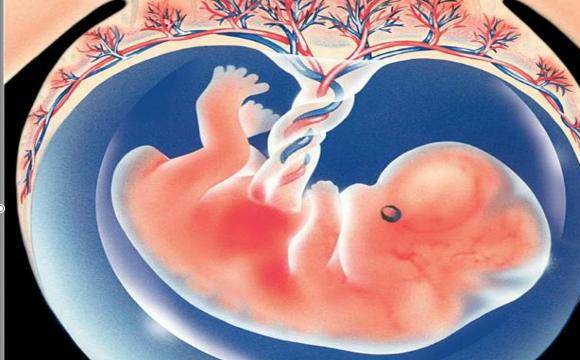 怀孕八个月胎儿发生"胎停育",是脐带扭转惹的祸,孕妈要重视