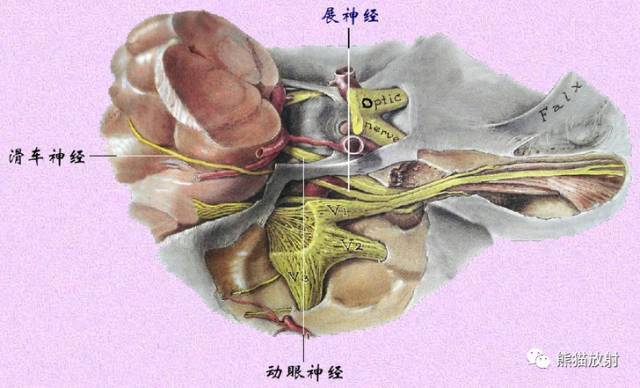 abducent nervevi 外展神经trigeminal nervev 三叉神经trochlear