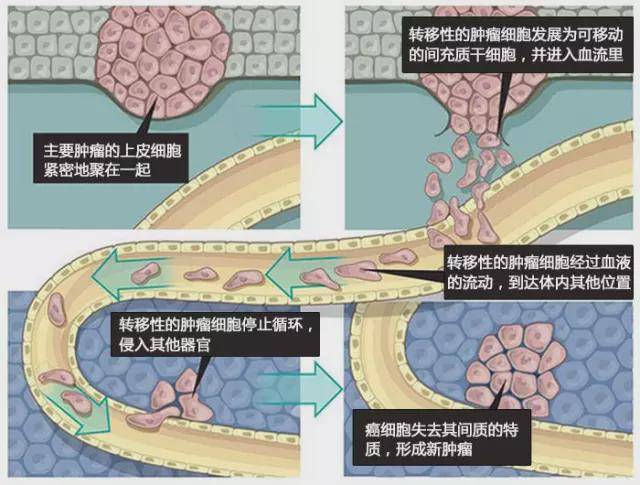 ▼发育途径的再生能够解释肿瘤细胞是如何侵入远距离组织的这些突变是