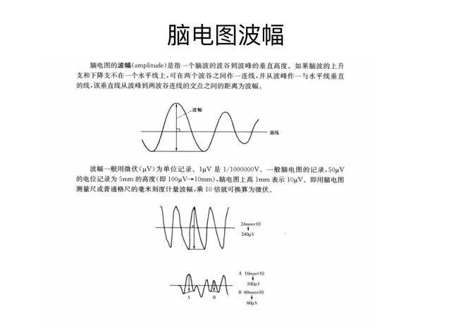 儿童脑电图基础与判读解析_波形