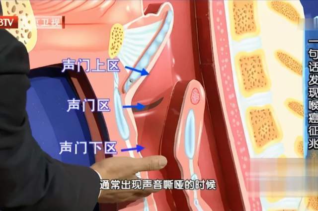 喉部也因为声带而分成声门上区,声门区,声门下区.