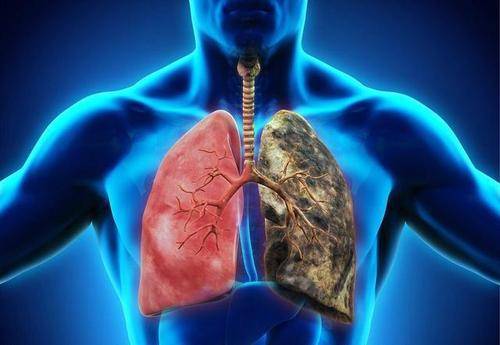 肺部发生不适,喉咙先知?若喉咙出现四个"异常",若占一个,值得注意