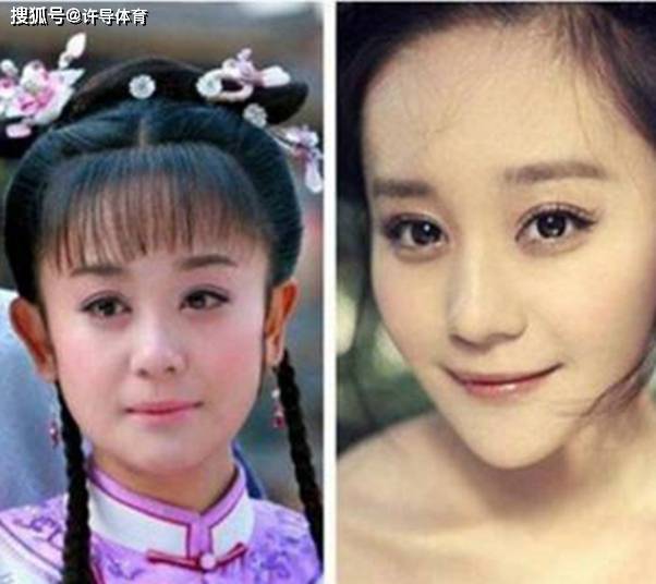 娱乐圈最"不该整容"的6位女星,她们越整越残,越整越"僵"