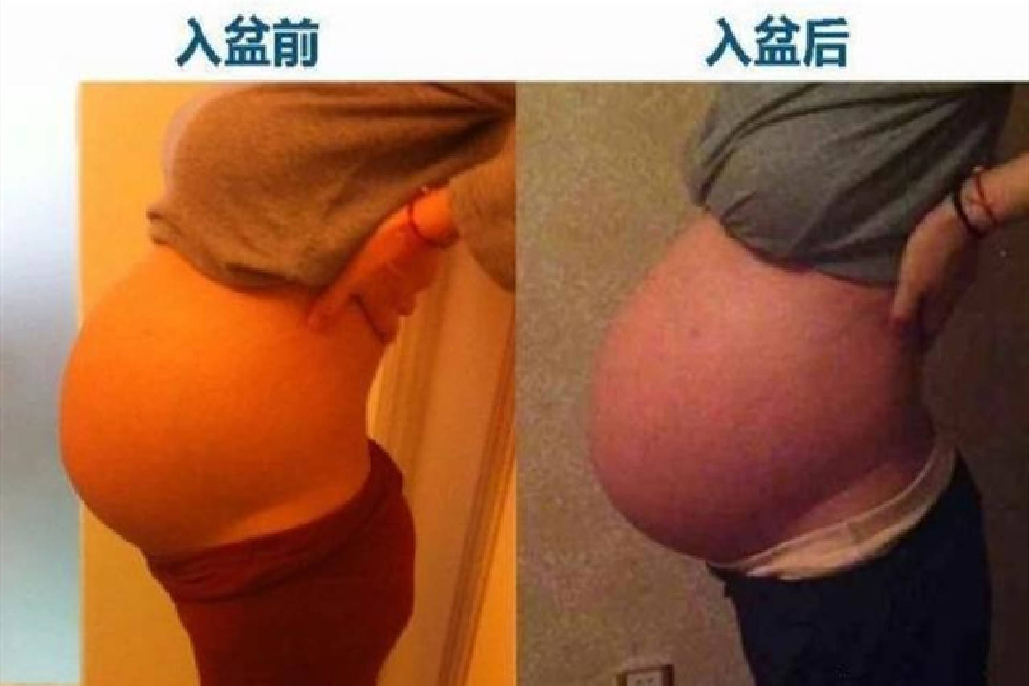 孕晚期胎兒入盆了是啥感覺？肚型有變化,6種表現也不一樣了