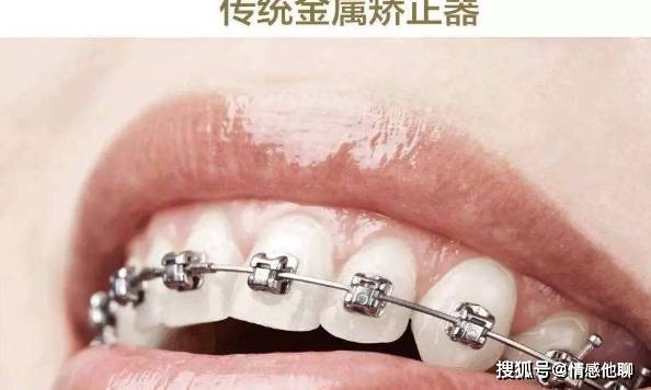 孩子牙齿畸形的背后是父母一手造成的