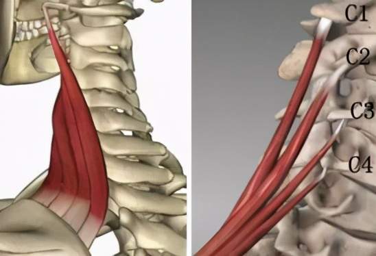 下部位于斜方肌的深面,为一对带状长肌,起自上4块颈椎的横突,肌纤维斜