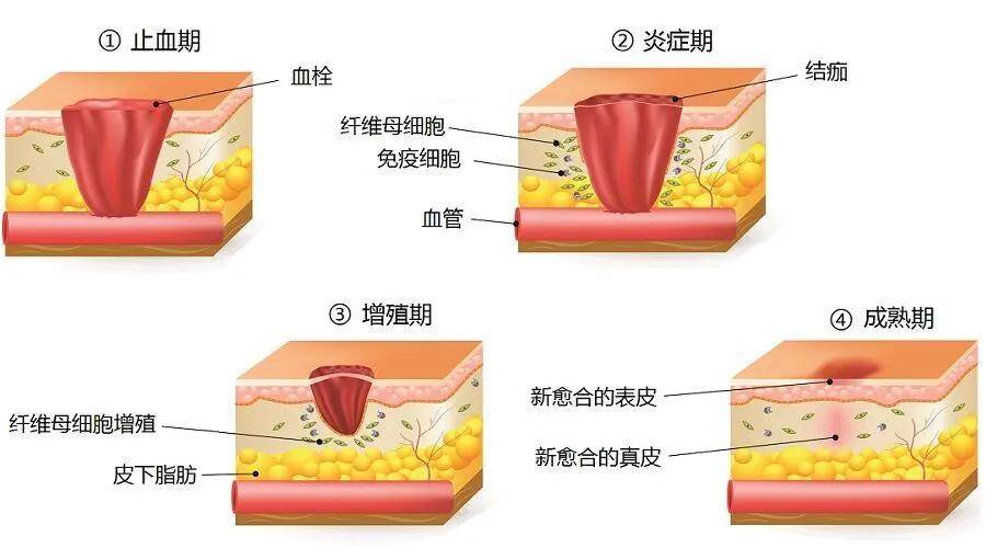 伤口愈合怎样才能不留痕?科学家们揭秘细胞的神奇力量