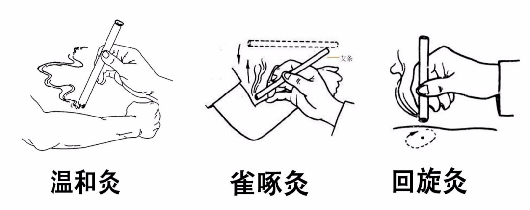 学做聪明艾灸人(一:科学艾灸流程_诊断