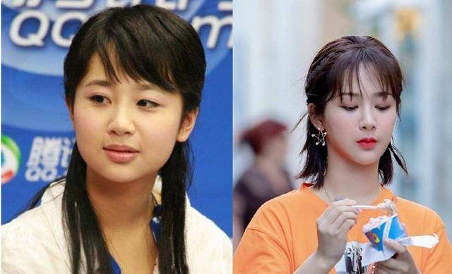 杨紫进整容医院引争议,她一直否认整容,但两个理由都没说服力