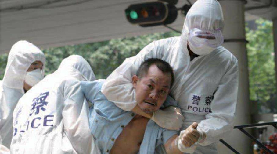 非典患者