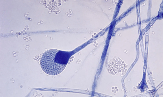 显微镜下的毛霉菌
