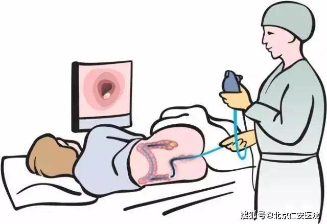 肠镜检查:彻底的肠道清洁