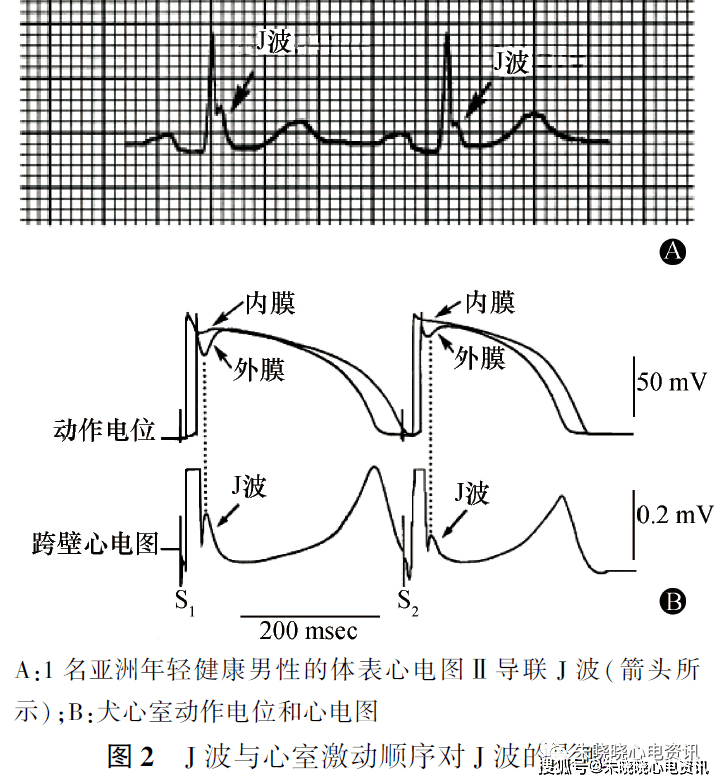 (2)心外膜心肌细胞的   相切迹与 ito 电流相关.