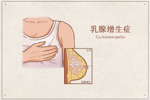 济南乳腺病医院_发现乳腺增生或乳腺结节怎么办?