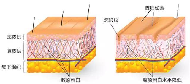 垂:面部软组织结构下移