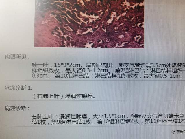 该院呼吸与危重症医学科副主任医师吉泽查看了王先生的检查报告后