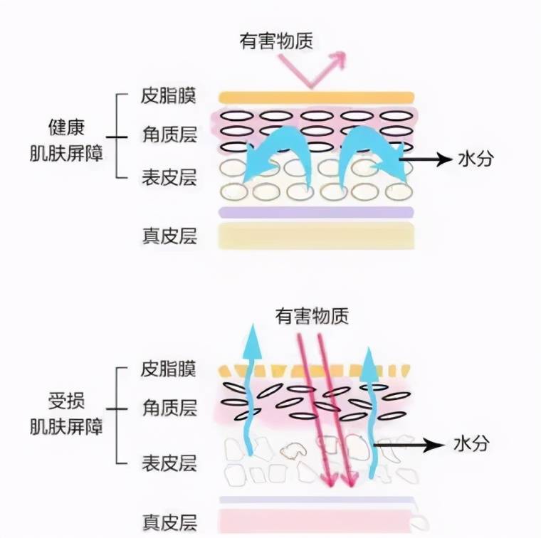 moodrose蒙蒂罗兰皮肤屏障皮肤最重要的一条防线