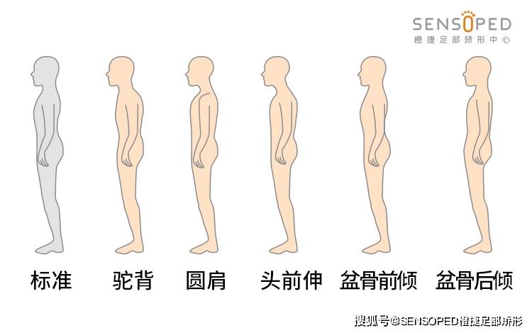 不重视的话不仅影响宝宝自信心,这些都是不良体态的早期表现宝