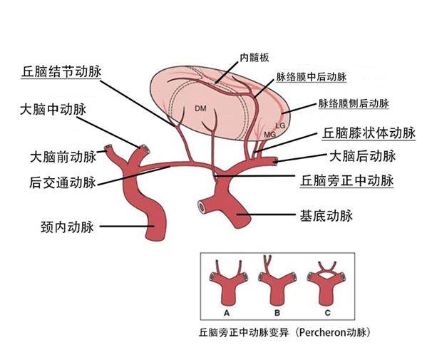 图文解说 丘脑对称性病变:20个具体实用解析