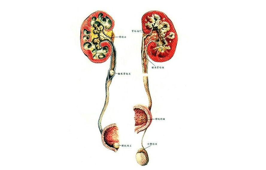 右肾发生萎缩肾脏功能受损