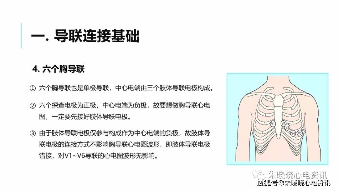 肢体导联电极错接心电图分析及鉴别ppt