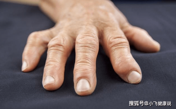 原创手指发麻,多半是8种病的先兆,不妨试试4种按摩!早知早受益